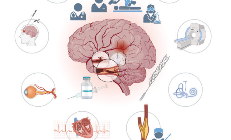 uniklinik-würzburg-weltschlaganfalltaf-2025