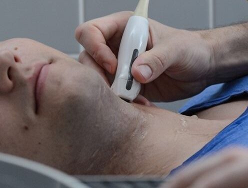 Schlaganfall: Erkennen, Behandeln und Vorbeugen